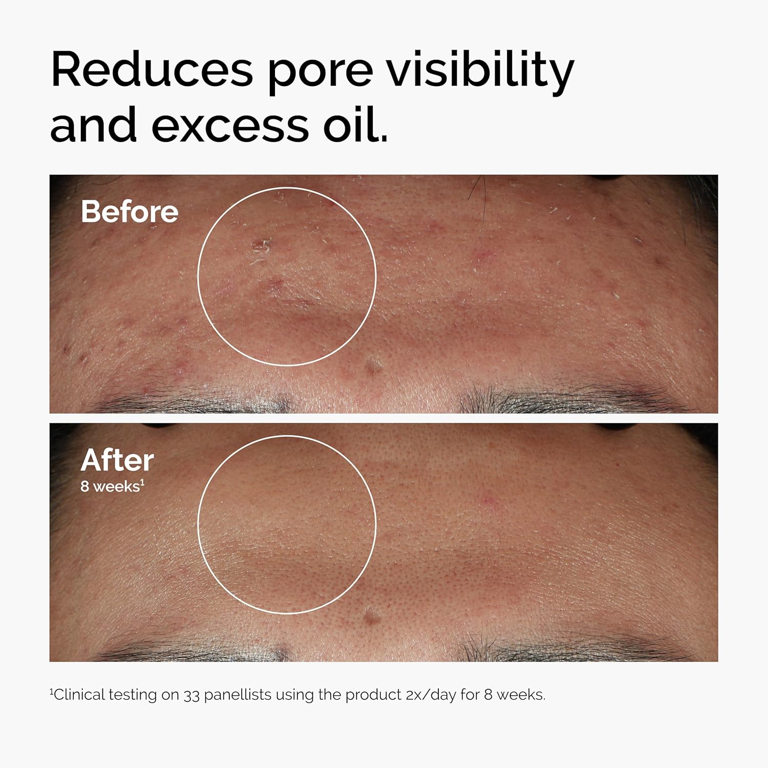 4% to 20% Niacinamide: Which Concentration Actually Matches Your Skin Concern